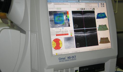 Diagnosing Glaucoma